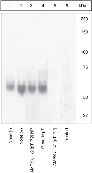 Anti-AMPK alpha 1 (phospho T183) + AMPK alpha 2 (phospho T172
