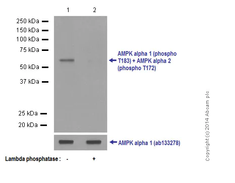 Western blot - Anti-AMPK alpha 1 (phospho T183) + AMPK alpha 2 (phospho T172) antibody [EPR5683] (AB133448)