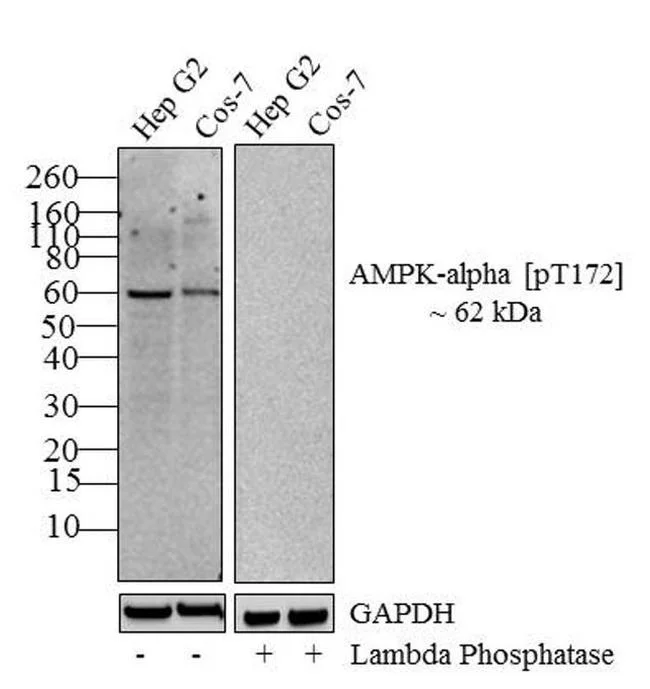 Western blot - Anti-AMPK alpha 1+AMPK alpha 2 (phospho T172 + T183) antibody [RP23040015] (AB307991)