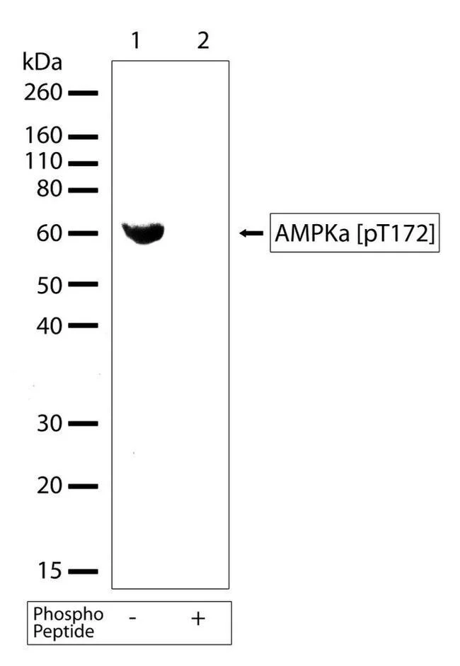 Western blot - Anti-AMPK alpha 1+AMPK alpha 2 (phospho T172 + T183) antibody [RP23040015] (AB307991)