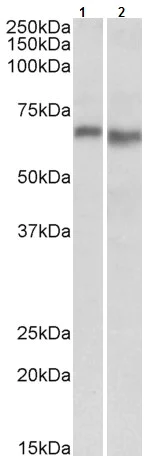 Western blot - Anti-AMPK alpha 2 antibody (AB105028)
