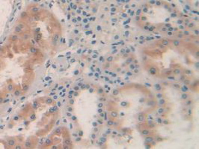 Immunohistochemistry (Formalin/PFA-fixed paraffin-embedded sections) - Anti-AMPK alpha 2 antibody (AB231807)