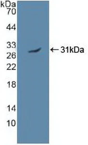 Western blot - Anti-AMPK alpha 2 antibody (AB231807)