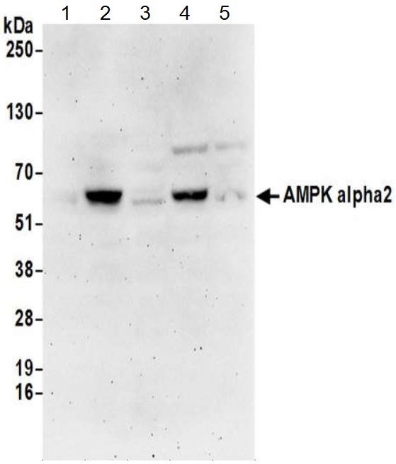 Western blot - Anti-AMPK alpha 2 antibody (AB3760)