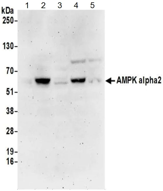 Western blot - Anti-AMPK alpha 2 antibody (AB3760)
