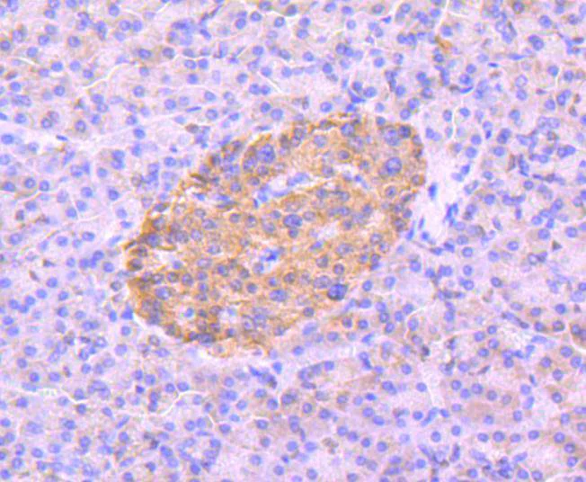 Immunohistochemistry (Formalin/PFA-fixed paraffin-embedded sections) - Anti-AMPK alpha 2 (phospho S345) antibody [JJ08-19] (AB326639)