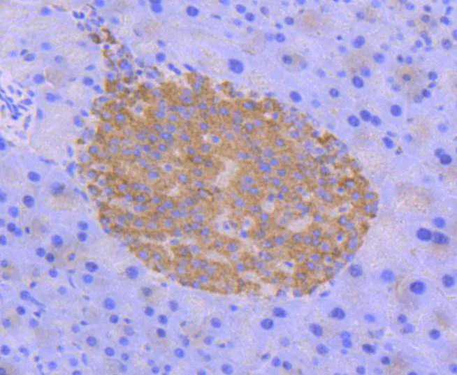 Immunohistochemistry (Formalin/PFA-fixed paraffin-embedded sections) - Anti-AMPK alpha 2 (phospho S345) antibody [JJ08-19] (AB326639)