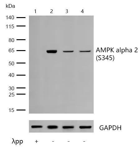 Western blot - Anti-AMPK alpha 2 (phospho S345) antibody [JJ08-19] (AB326639)