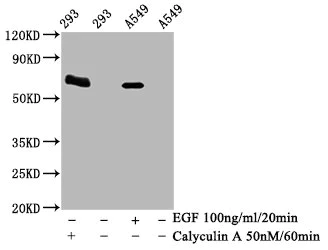 Western blot - Anti-AMPK alpha 2 (phospho T172) antibody [4F4] (AB314032)