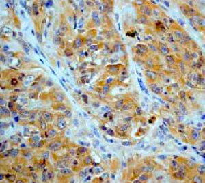 Immunohistochemistry (Formalin/PFA-fixed paraffin-embedded sections) - Anti-AMPK beta 1 antibody [Y367] (AB32112)