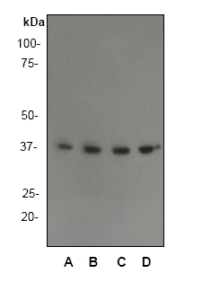 Western blot - Anti-AMPK beta 1 antibody [Y367] (AB32112)