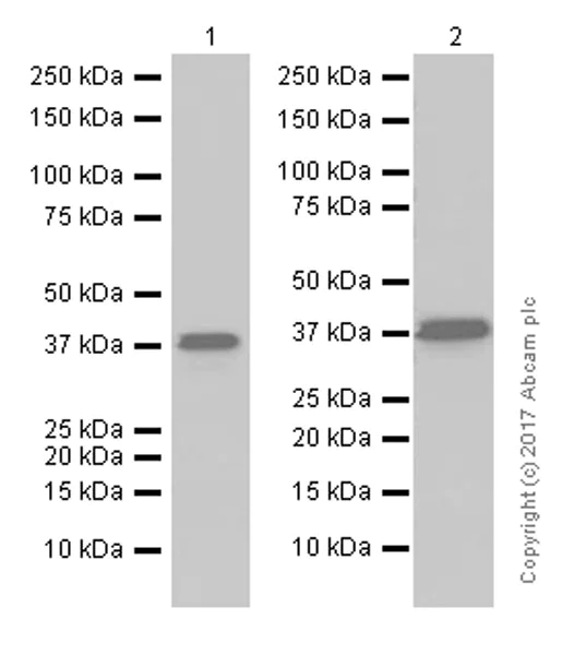 Western blot - Anti-AMPK beta 1 antibody [Y367] (AB32112)