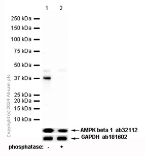 Western blot - Anti-AMPK beta 1 (phospho S181) antibody [EP2181Y] (AB68206)