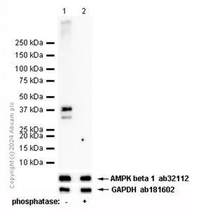 Western blot - Anti-AMPK beta 1 (phospho S181) antibody [EP2181Y] - BSA and Azide free (AB284711)