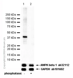 Western blot - Anti-AMPK beta 1 (phospho S181) antibody [EP2181Y] - BSA and Azide free (AB284711)