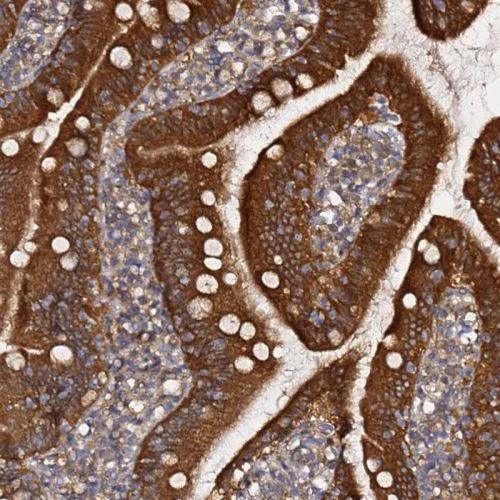 Immunohistochemistry (Formalin/PFA-fixed paraffin-embedded sections) - Anti-AMPK beta 2/PRKAB2 antibody (AB244472)