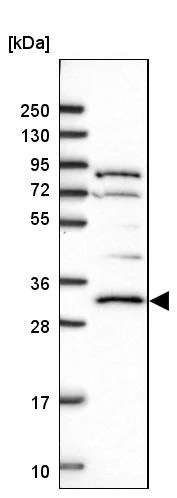 Western blot - Anti-AMPK beta 2/PRKAB2 antibody (AB244472)