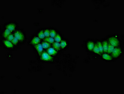 Immunocytochemistry/ Immunofluorescence - Anti-AMPK gamma 1 antibody (AB223116)