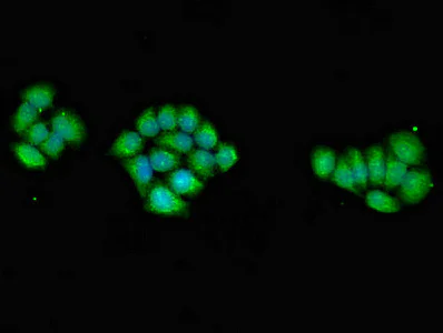 Immunocytochemistry/ Immunofluorescence - Anti-AMPK gamma 1 antibody (AB223116)