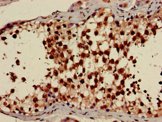 Immunohistochemistry (Formalin/PFA-fixed paraffin-embedded sections) - Anti-AMPK gamma 1 antibody (AB223116)