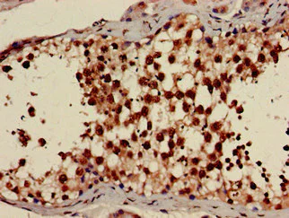 Immunohistochemistry (Formalin/PFA-fixed paraffin-embedded sections) - Anti-AMPK gamma 1 antibody (AB223116)