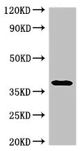 Western blot - Anti-AMPK gamma 1 antibody (AB223116)