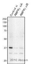 Western blot - Anti-AMPK gamma 1 antibody [Y307] (AB32382)