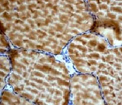 Immunohistochemistry (Formalin/PFA-fixed paraffin-embedded sections) - Anti-AMPK gamma 1 antibody [Y307] - BSA and Azide free (AB247251)