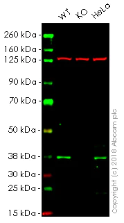 Western blot - Anti-AMPK gamma 1 antibody [Y307] - BSA and Azide free (AB247251)