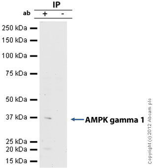Immunoprecipitation - Anti-AMPK gamma 1 antibody [Y308] (AB32508), expandable thumbnail
