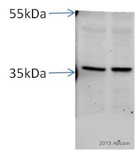 Western blot - Anti-AMPK gamma 1 antibody [Y308] (AB32508), expandable thumbnail