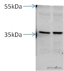 Western blot - Anti-AMPK gamma 1 antibody [Y308] (AB32508)