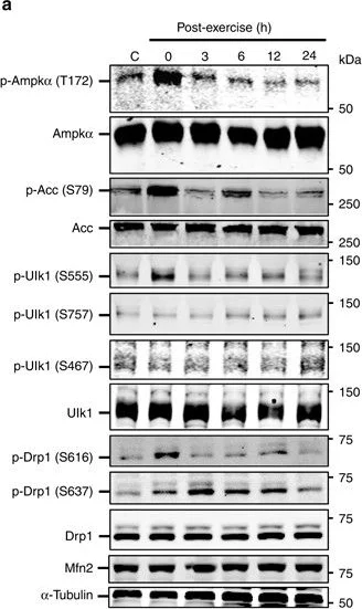 Western blot - Anti-AMPK gamma 1 antibody [Y308] (AB32508)
