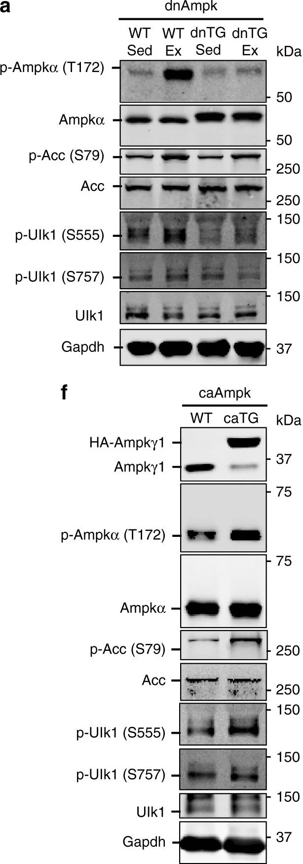 Western blot - Anti-AMPK gamma 1 antibody [Y308] (AB32508)