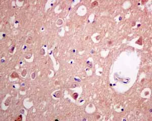 Immunohistochemistry (Formalin/PFA-fixed paraffin-embedded sections) - Anti-AMPS antibody [EPR10747(B)] (AB154182)