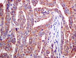 Immunohistochemistry (Formalin/PFA-fixed paraffin-embedded sections) - Anti-AMPS antibody [EPR10747(B)] (AB154182)