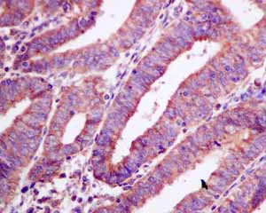 Immunohistochemistry (Formalin/PFA-fixed paraffin-embedded sections) - Anti-AMPS antibody [EPR10747(B)] - BSA and Azide free (AB249082)