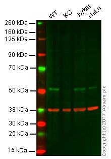 Western blot - Anti-AMSH antibody [EPR4361] (AB108301)