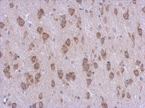 Immunohistochemistry (Formalin/PFA-fixed paraffin-embedded sections) - Anti-AMSH-LP antibody (AB229144)