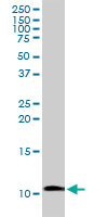Western blot - Anti-Amylin/DAP antibody (AB103580)