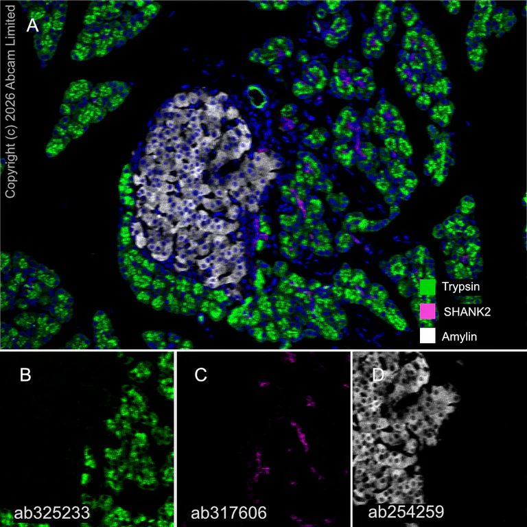 Multiplex immunohistochemistry - Anti-Amylin/DAP antibody [EPR22556-138] - BSA and Azide free (AB255329)