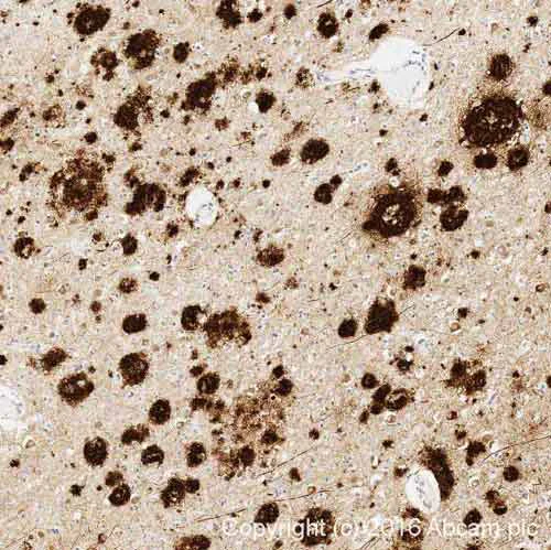 Immunohistochemistry (Formalin/PFA-fixed paraffin-embedded sections) - Anti-Amyloid Fibril antibody [mOC22] - Conformation-Specific (AB205339)