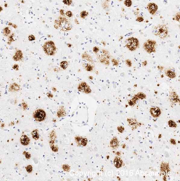Immunohistochemistry (Formalin/PFA-fixed paraffin-embedded sections) - Anti-Amyloid Fibril antibody [mOC78] - Conformation-Specific (AB205341), expandable thumbnail