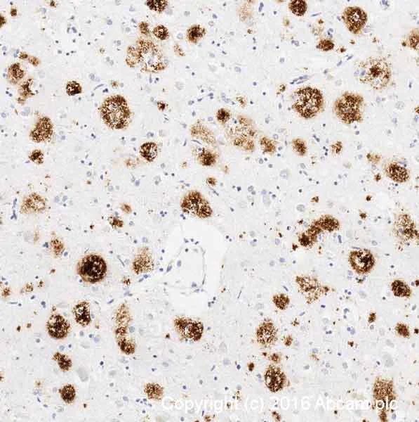 Immunohistochemistry (Formalin/PFA-fixed paraffin-embedded sections) - Anti-Amyloid Fibril antibody [mOC78] - Conformation-Specific (AB205341)