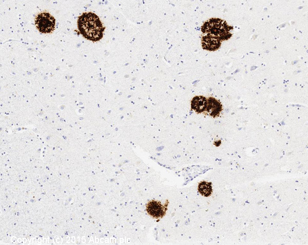 Immunohistochemistry (Formalin/PFA-fixed paraffin-embedded sections) - Anti-Amyloid Fibril antibody [mOC87] - BSA and Azide free (AB251335), expandable thumbnail