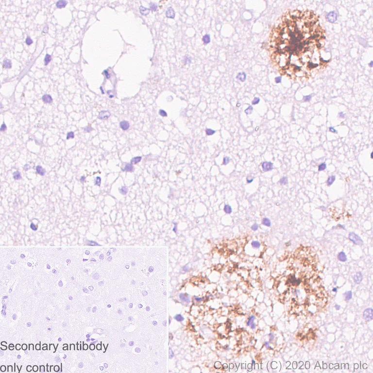 Immunohistochemistry (Formalin/PFA-fixed paraffin-embedded sections) - Anti-Amyloid Precursor Protein antibody [1B5] - BSA and Azide free (AB273481)