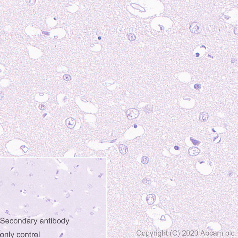 Immunohistochemistry (Formalin/PFA-fixed paraffin-embedded sections) - Anti-Amyloid Precursor Protein antibody [1B5] - BSA and Azide free (AB273481)