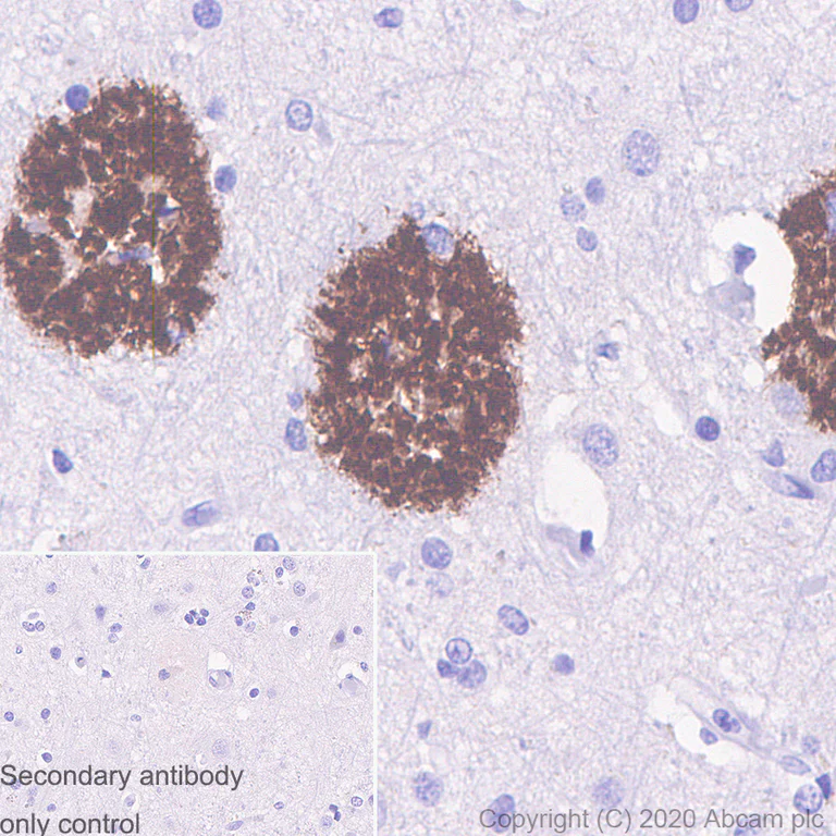 Immunohistochemistry (Formalin/PFA-fixed paraffin-embedded sections) - Anti-Amyloid Precursor Protein antibody [7C8] (AB273452)