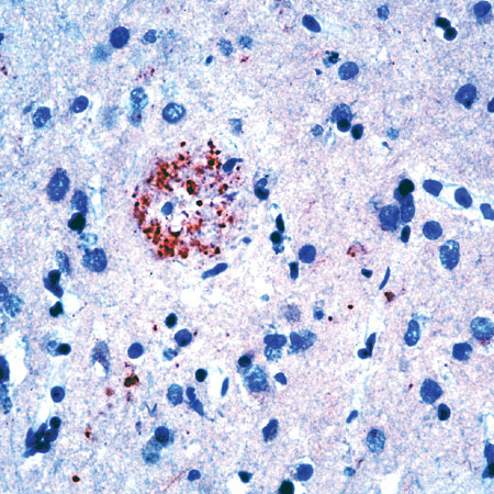 Immunohistochemistry (Formalin/PFA-fixed paraffin-embedded sections) - Anti-Amyloid Precursor Protein antibody (AB15272), expandable thumbnail