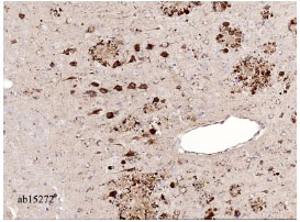 Immunohistochemistry (Formalin/PFA-fixed paraffin-embedded sections) - Anti-Amyloid Precursor Protein antibody (AB15272), expandable thumbnail